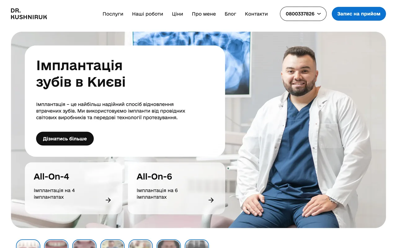 implantatsiya